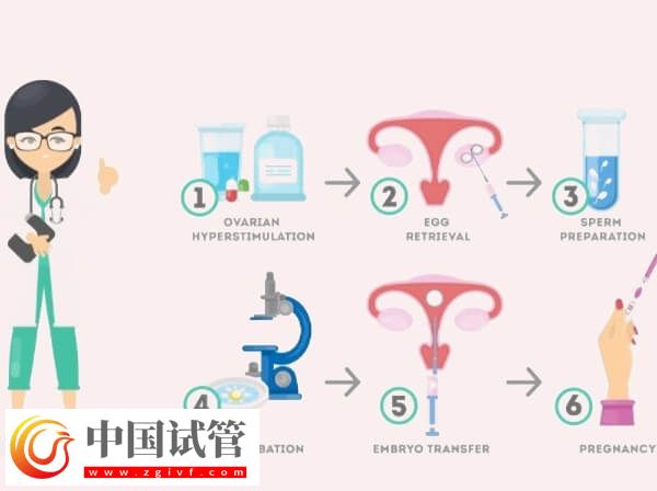 北京協(xié)和試管嬰兒全過程(圖1)