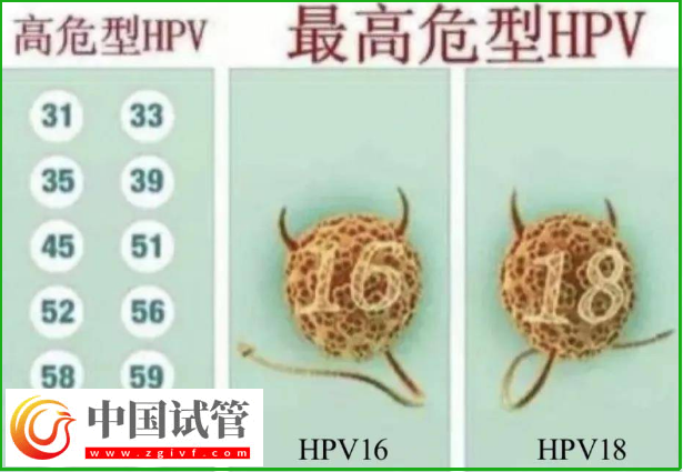 通過hpv報(bào)告單圖片怎么判斷自己是正常的呢？(圖3)