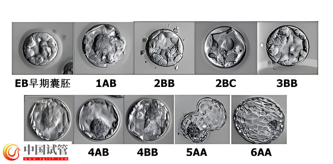 囊胚等級(jí)與寶寶健康之間有關(guān)系嗎？(圖3)
