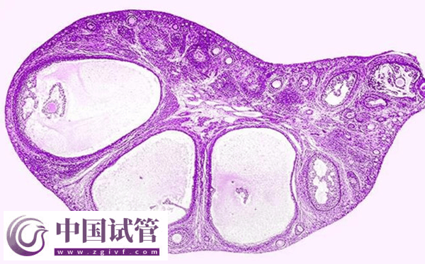 河南省人民醫院做試管嬰要準備什么(圖3)