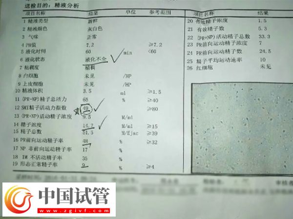 河南省人民醫院做試管嬰要準備什么(圖2)